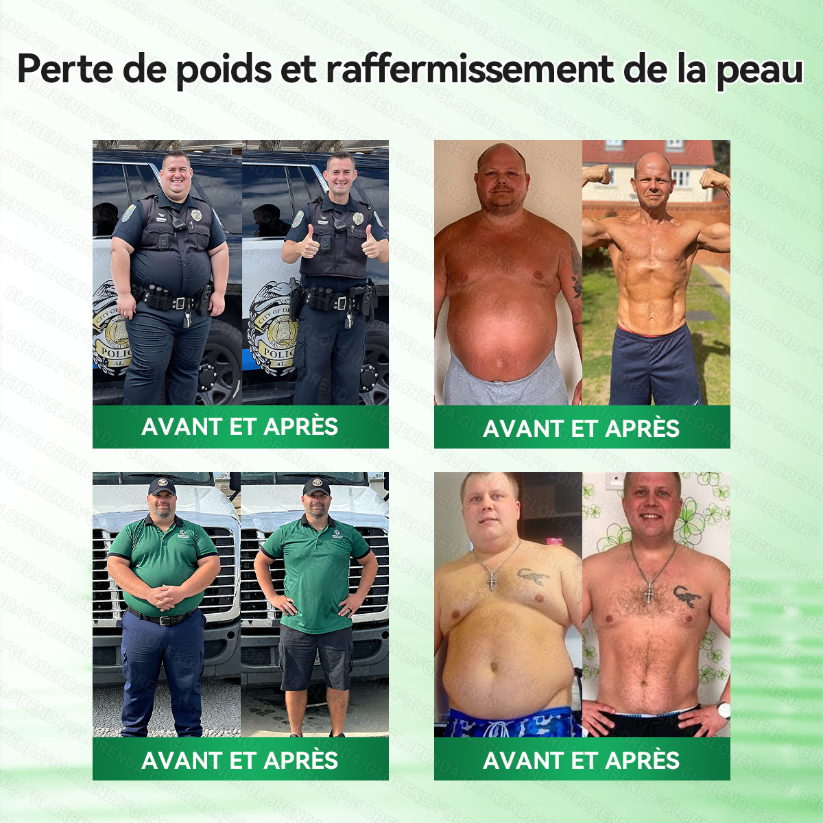 | 🇧🇪 Boutique officielle | 🧑‍⚕️🌿 𝐂𝐥𝐞𝐚𝐫𝐞𝐧𝐚® Moringa · Berbérine + NAD+ – Patch Microneedle Nano Avancé 10-en-1 (1×/jour, résultats visibles en 7 jours) | Obésité, relâchement cutané, apnée du sommeil, articulations, etc.